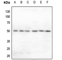 1 - Anti-Secretin Receptor Antibody AP60629
