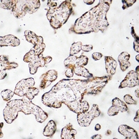 19 - Anti-PEDF Antibody AP60630