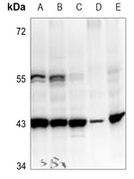 1 - Anti-PEDF Antibody AP60630