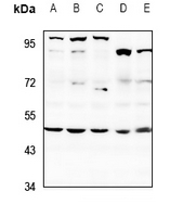 1 - Anti-SAP49 Antibody AP60631