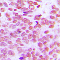 19 - Anti-Lupus La Antibody AP60635