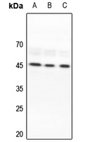1 - Anti-Lupus La Antibody AP60635