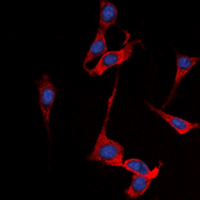 3 - Anti-SSTR1 Antibody AP60636