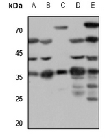 1 - Anti-SSTR1 Antibody AP60636