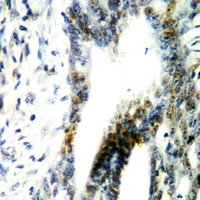 19 - Anti-LKB1 (Phospho-T189) Antibody AP60638