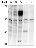 1 - Anti-LKB1 (Phospho-T189) Antibody AP60638