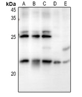 1 - Anti-RB3 Antibody AP60639