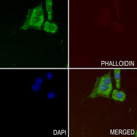 3 - Anti-TAO1 Antibody AP60640