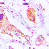 19 - Anti-TAO1 Antibody AP60640