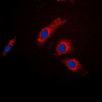 3 - Anti-AS160 Antibody AP60641