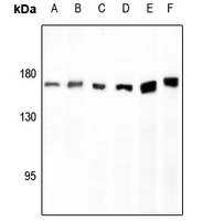 1 - Anti-AS160 Antibody AP60641