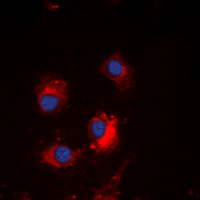 3 - Anti-TCF6 Antibody AP60642