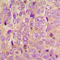 19 - Anti-TCF6 Antibody AP60642