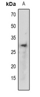 1 - Anti-TCF6 Antibody AP60642