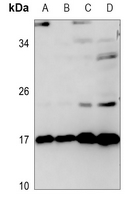 1 - Anti-TNFAIP8L2 Antibody AP60643