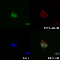 3 - Anti-p53 (Phospho-S6) Antibody AP60644