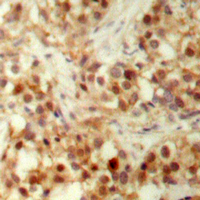 19 - Anti-p53 (Phospho-S6) Antibody AP60644