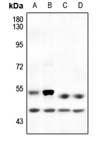 1 - Anti-p53 (Phospho-S6) Antibody AP60644