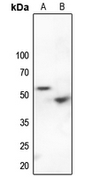 1 - Anti-p53 (Phospho-S9) Antibody AP60645