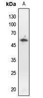 1 - Anti-p53 (Phospho-T18) Antibody AP60646
