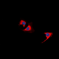 3 - Anti-TUSC5 Antibody AP60648