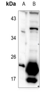 1 - Anti-TUSC5 Antibody AP60648