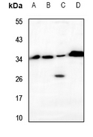 1 - Anti-VTI1B Antibody AP60650