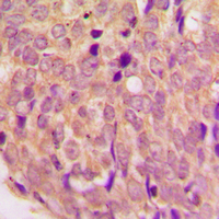 19 - Anti-WASF1 Antibody AP60651