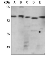 1 - Anti-WASF1 Antibody AP60651