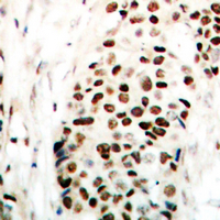 19 - Anti-NIPA (Phospho-S354) Antibody AP60652