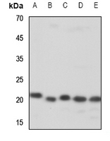 1 - Anti-ZNF695 Antibody AP60655