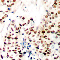 19 - Anti-ZNF75D Antibody AP60656