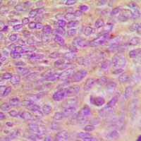 19 - Anti-ARHGEF7 Antibody AP60657