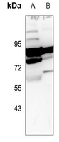 1 - Anti-ARHGEF7 Antibody AP60657