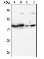 1 - Anti-CD296 Antibody AP60658