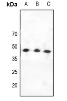 1 - Anti-CCKAR Antibody AP60661