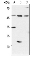 1 - Anti-CD1d Antibody AP60662