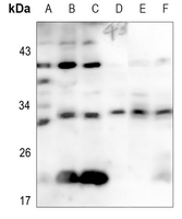 1 - Anti-CD69 Antibody AP60663