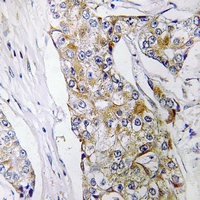 19 - Anti-DHRS11 Antibody AP60664