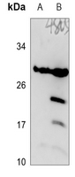 1 - Anti-DHRS11 Antibody AP60664