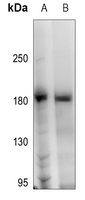 1 - Anti-HER2 (Phospho-Y1248) Antibody AP60667