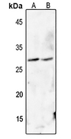 1 - Anti-FADD (Phospho-S194) Antibody AP60668