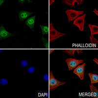 3 - Anti-FGFR4 Antibody AP60670