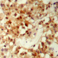 19 - Anti-FOXO3 (Phospho-S253) Antibody AP60671