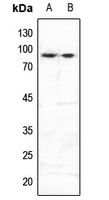 1 - Anti-FOXO3 (Phospho-S253) Antibody AP60671