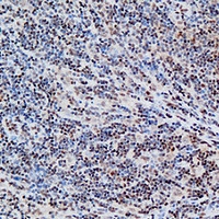 19 - Anti-FOXP1 Antibody AP60672
