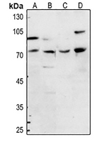 1 - Anti-FOXP1 Antibody AP60672