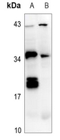 1 - Anti-IL-26 Antibody AP60674
