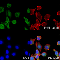 3 - Anti-IL-6 Antibody AP60675