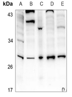 1 - Anti-IL-6 Antibody AP60675